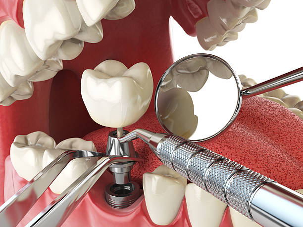 Best Emergency Cosmetic Dentistry in Cotati, CA